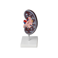 Модель почки в разрезе - «globural.ru» - Кировград