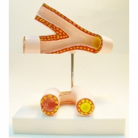 Модель "Здоровые и поврежденные сосуды"	 - «globural.ru» - Кировград