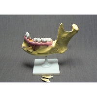 Модель "Челюсть разборная" - «globural.ru» - Кировград