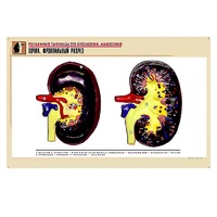 Рельефная таблица "Почка. Фронтальный разрез" (формат А1, матовое ламинир.) - «globural.ru» - Кировград